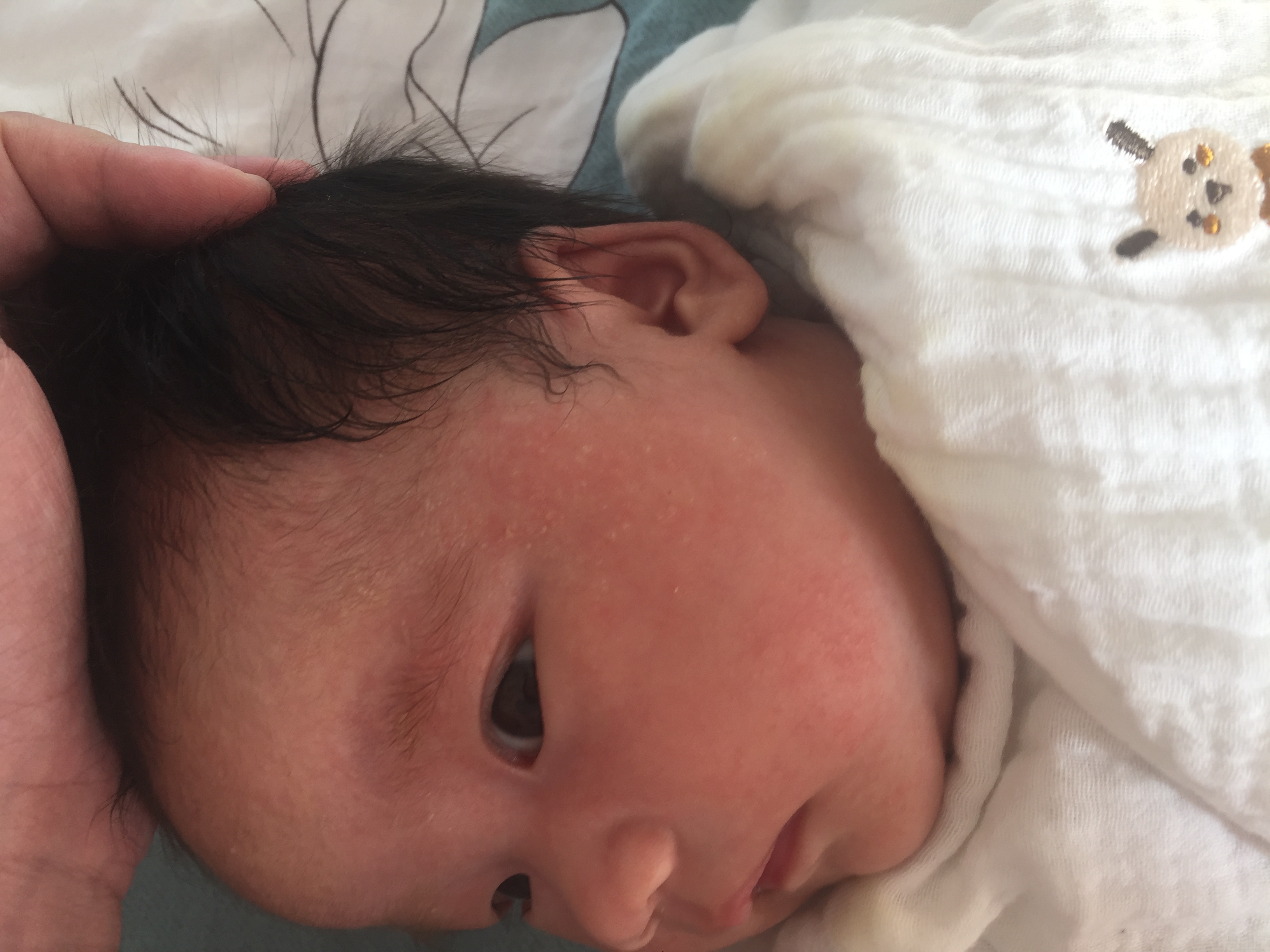 宝宝得湿疹妈妈怎么忌口,宝宝湿疹怎么办宝妈分享