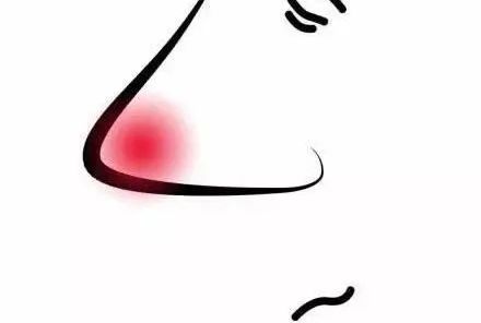 皮肤敏感泛红起皮怎么办,敏感肌皮肤发红怎么调理