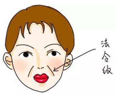 法令纹怎么消除最快,额头法令纹怎么消除