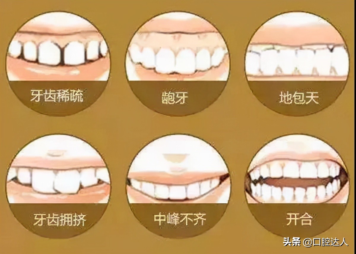 年龄大了牙齿松动掉落怎么办,小孩换牙牙齿松动掉落怎么扯掉