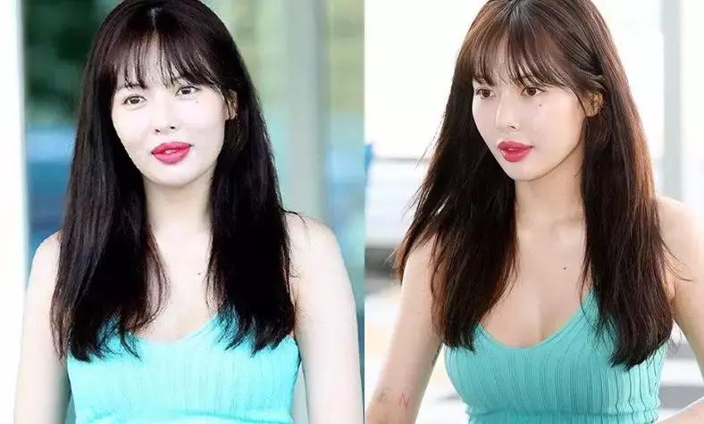 泫雅嘴唇前后对比,泫雅现在嘴唇好看吗