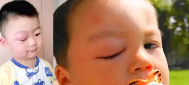 好物纯分享I暑期赴法旅行，都托朋友捎带这些药妆回来