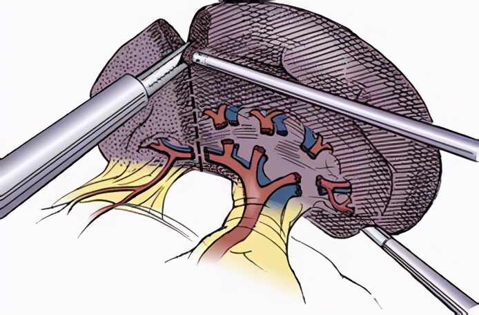 脾脏大有什么问题,脾脏不好怎么治疗最好