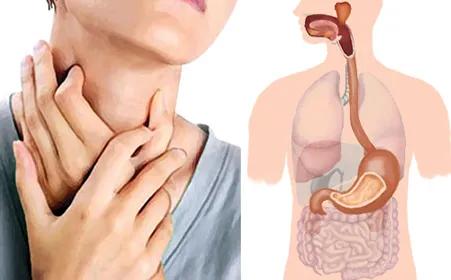 慢性咽炎有异物感吃什么药效果好,慢性咽喉炎吃咽炎片能完全治愈吗