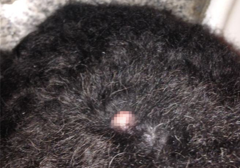 狗脂肪瘤会长大吗,肝上有个脂肪瘤与脂肪肝有关联吗