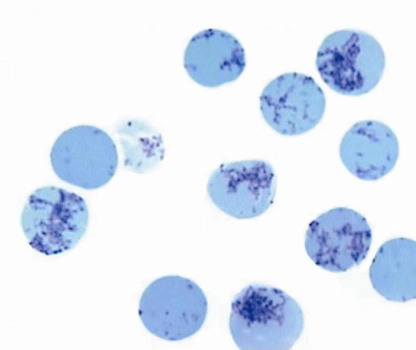 网织红细胞是检查什么,未成熟网织红细胞是什么