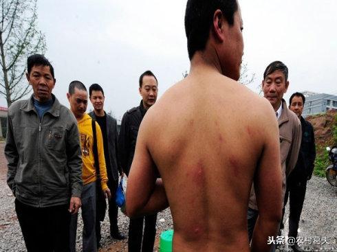 被蜜蜂蛰了以后注意事项,在野外被蜜蜂蛰了怎么办