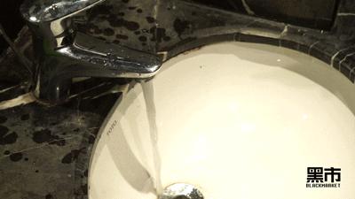 窜出来的鼻毛可以拔吗,窜出鼻子的鼻毛有必要修剪吗