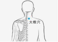 落枕了教你落枕的正确处理方法,落枕怎么办教你三个动作
