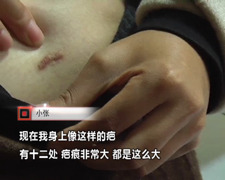 女子抽脂术后皮肤坏死,抽脂后身上掉皮