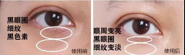 雅诗兰黛日本产的眼霜,用了雅诗兰黛皱纹更明显了