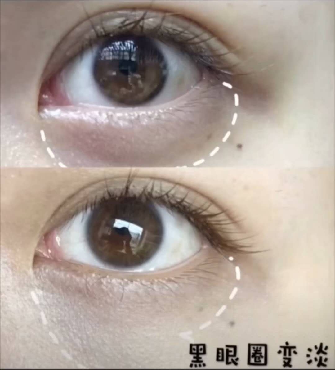 吴昕推荐眼霜,吴昕推荐眼霜好用吗视频