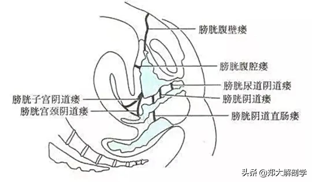 女性盆底功能障碍性疾病表现,南通治疗盆底功能障碍的医院