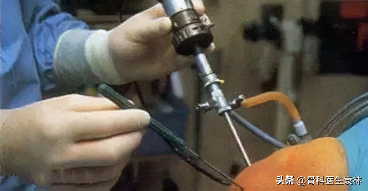 治疗老年关节炎最好方法,老年人关节炎最新治疗方法