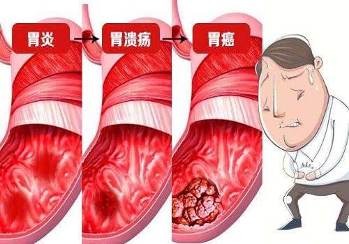 胃溃疡吃什么调理最好,胃溃疡能吃植物油吗