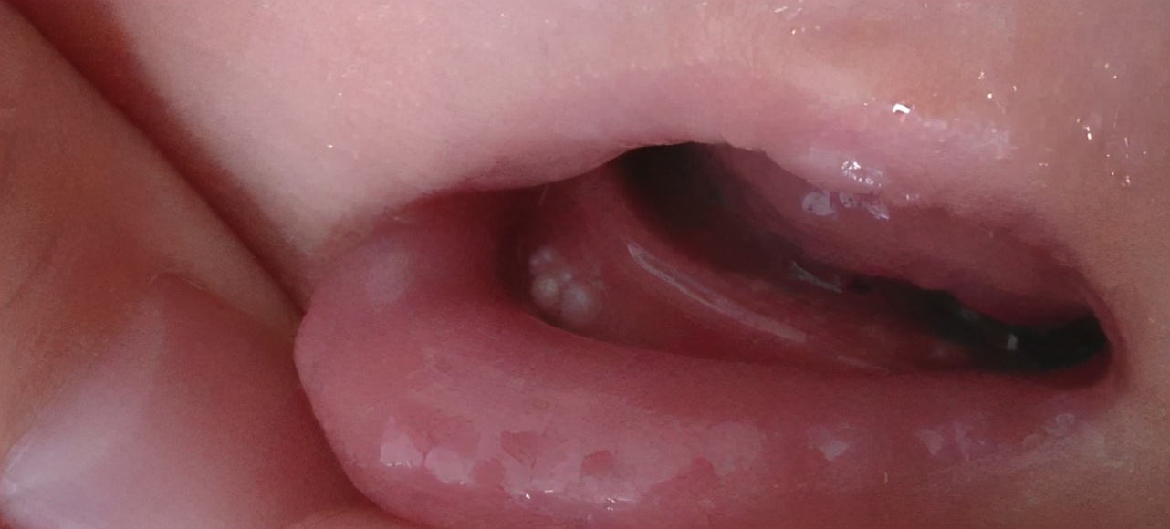 新生儿护理知识大全100题,育儿小知识新生儿护理常见知识