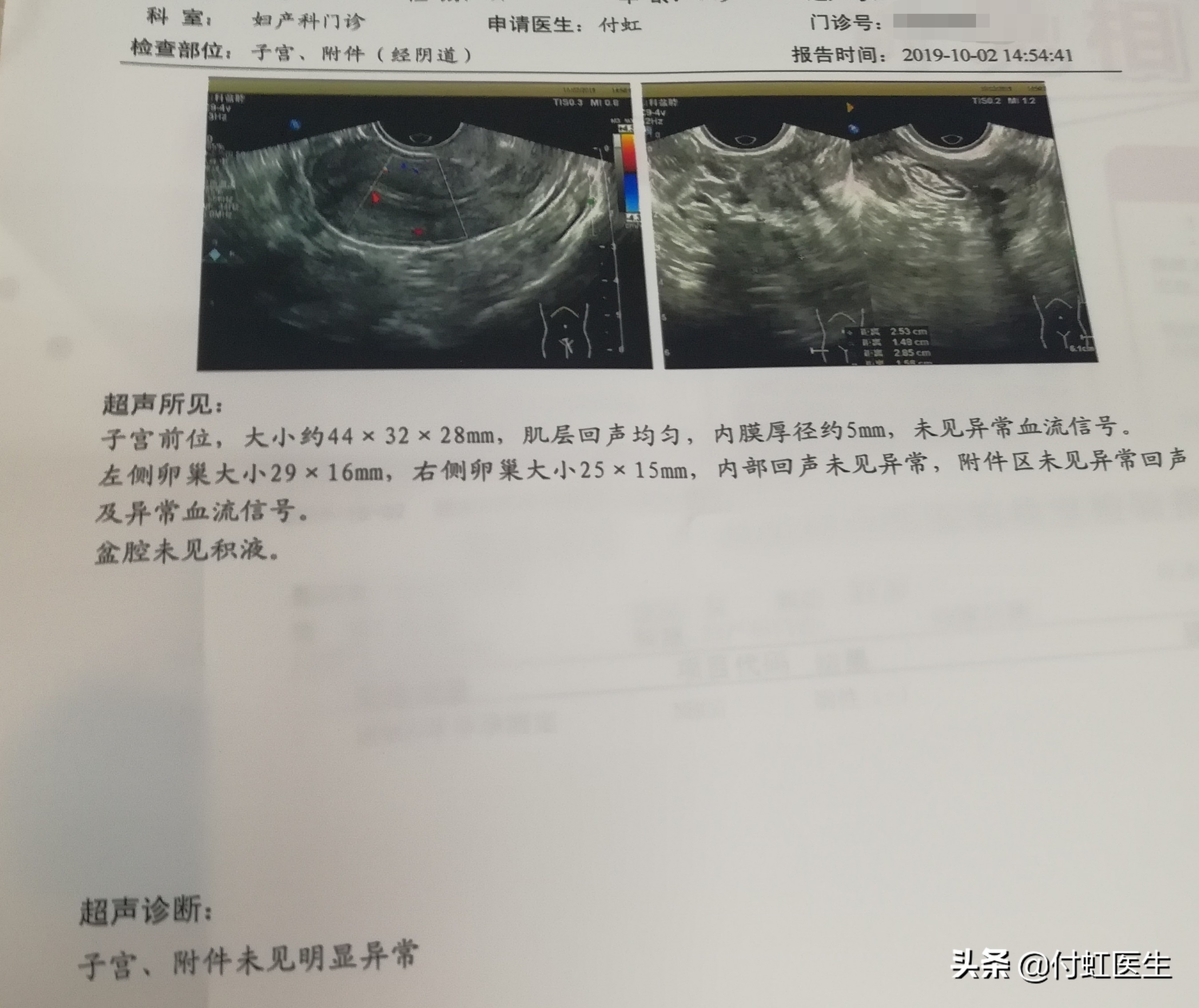 #健康真相馆#妇科急诊：月经推迟却不是怀孕？