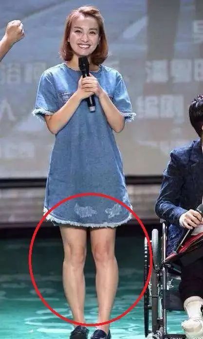 吴昕粗腿对比图,34岁的吴昕近照曝光