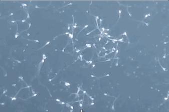 跳蚤在显微镜下长什么样,把显微镜放大40亿倍