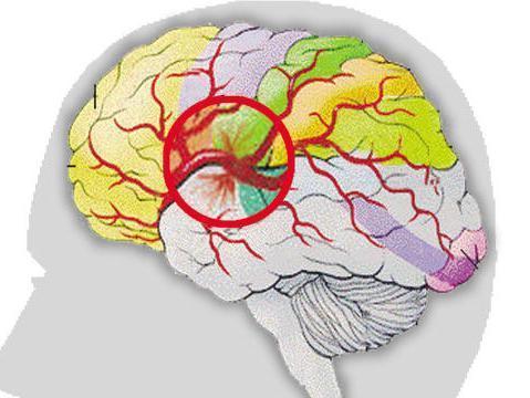 麻醉苏醒延迟的原因,全身麻醉后苏醒延迟是指