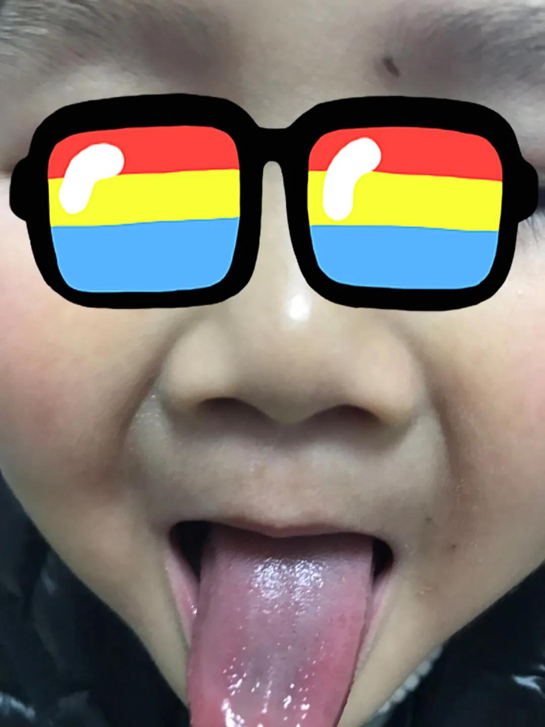 怎么做才能缓解鼻窦炎,怎么样才能根治儿童鼻炎鼻窦炎