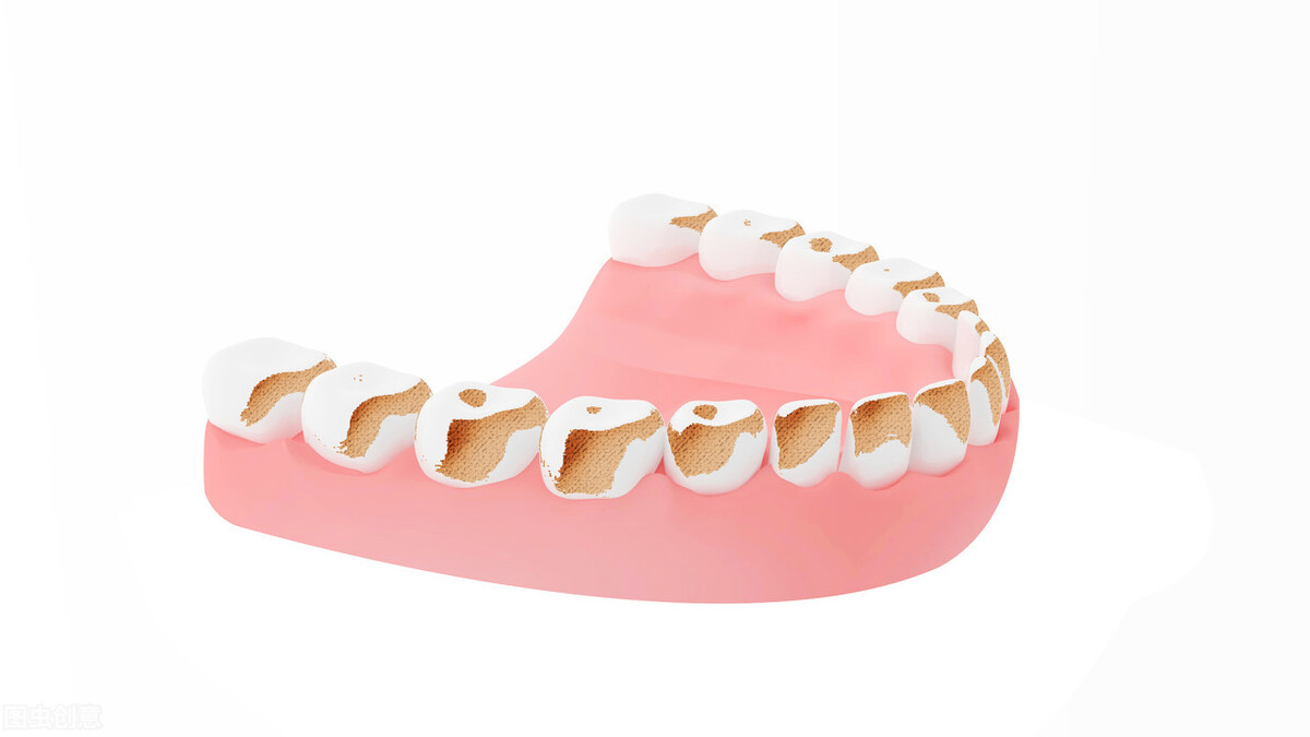 usmile冲牙器和医院洗牙一样吗,冲牙器可以代替洗牙吗