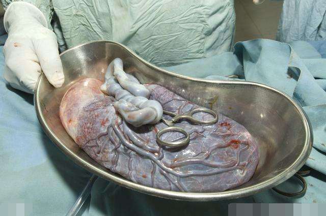 中国婆婆捧上天的胎盘真相,关于胎盘的真相