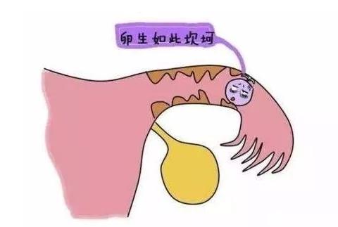 输卵管堵塞手术疏通多少钱,输卵管堵了怎么办啊