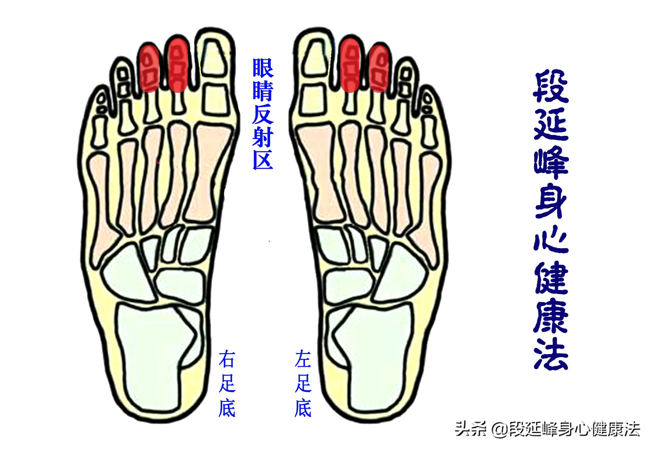 严重黑眼圈可以逆转吗,延峰治疗黑眼圈