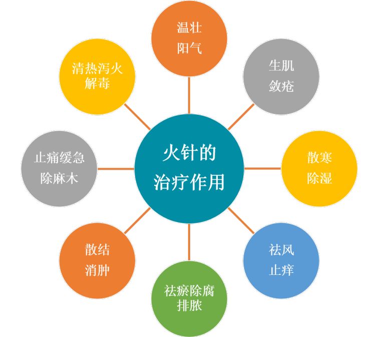 中医火针疗法教学视频,火针操作手法
