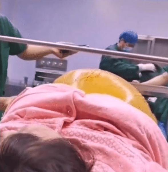 抗麻体质生宝宝剖腹产怎么办,抗麻体质可以生二胎吗