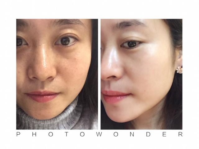 屈臣氏导购推荐的水乳,屈臣氏隐藏好物推荐水乳