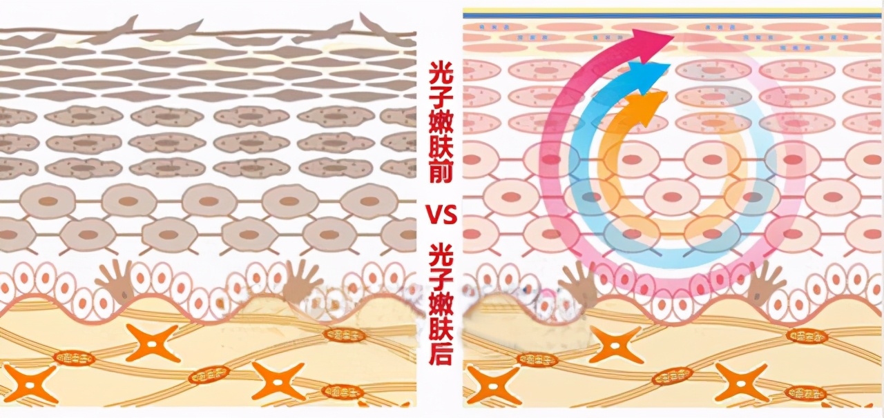 谣言粉碎机有哪些功能,谣言粉碎机排毒