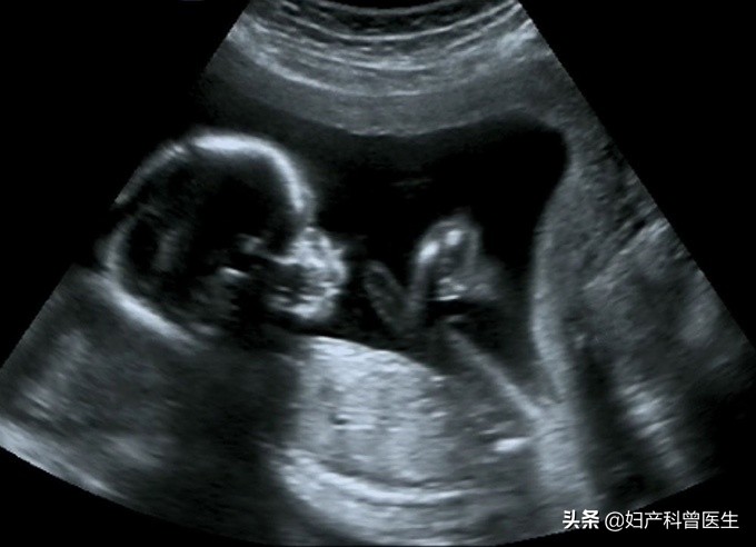孕期多做b超对胎儿有影响吗,孕期做b超对胎儿有什么影响