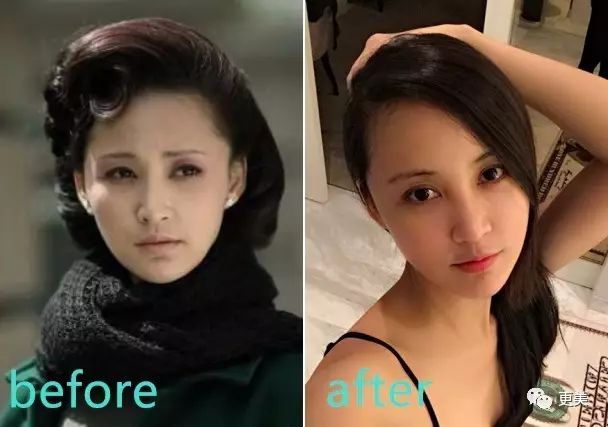 15天暴瘦20斤,却意外暴露了她填充过度的馒头脸