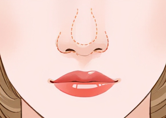 怎么日常改变鼻型,鼻型不好看怎么调整