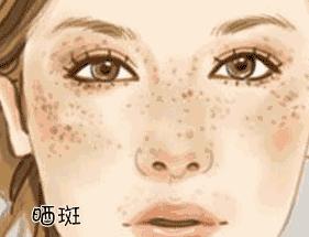 皮肤科博士护肤品推荐,皮肤科医学博士用什么护肤