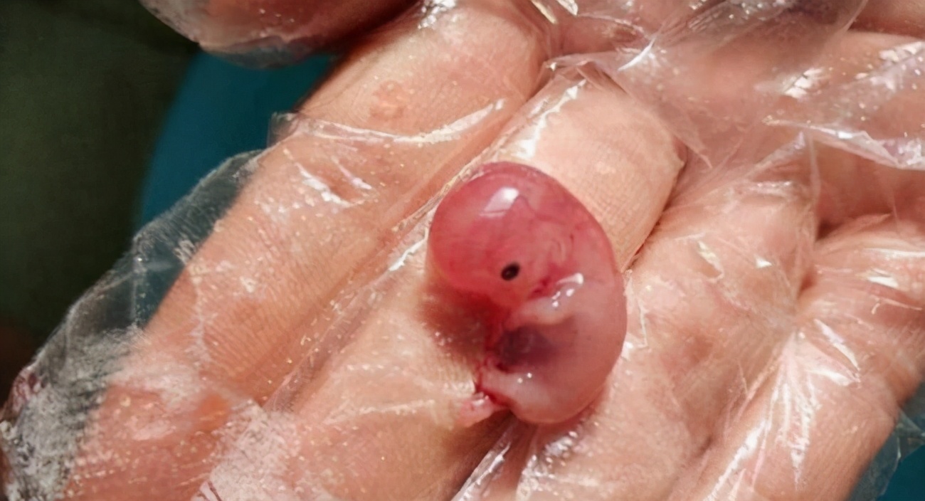 60多天流产下来的胎囊形状,60天流产出来的婴儿感觉到痛吗