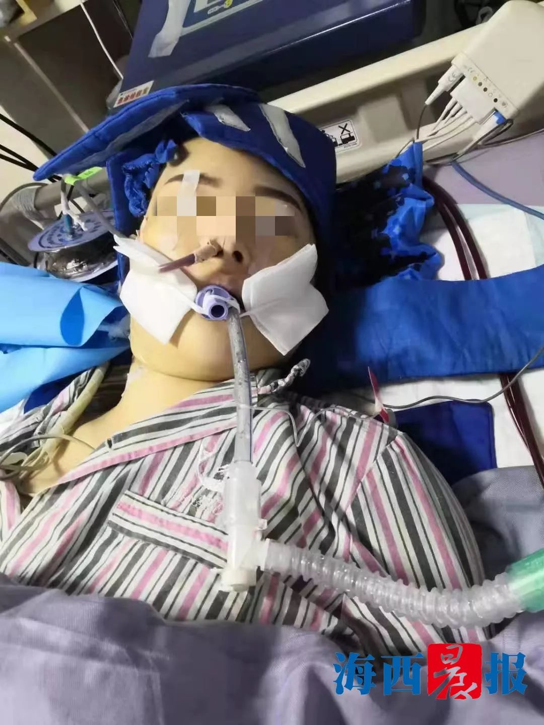 舞蹈老师厦门抽脂昏迷不醒,舞蹈老师抽脂