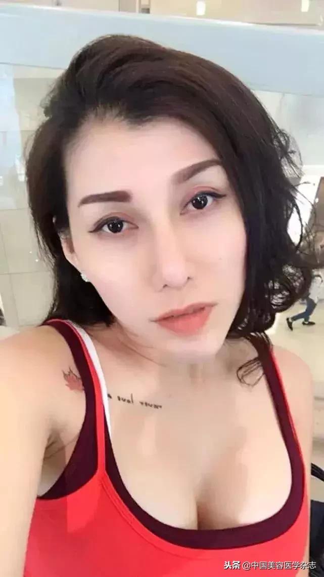 女歌手花1.4万元隆的胸在飞机上“爆了”！