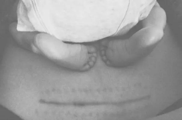 拿什么拯救你我的快乐,拿什么拯救你我身上的疤痕