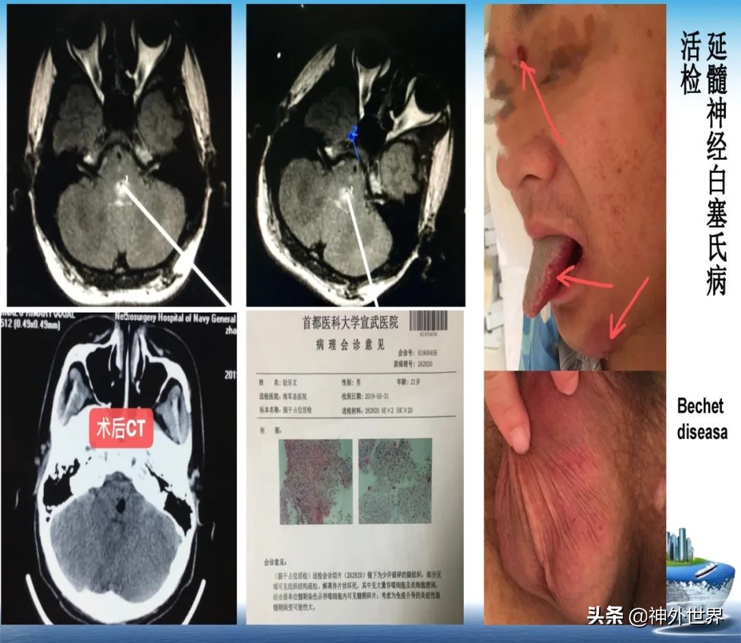 宣武医院神经外科王亚明祖籍,北京宣武医院神经科专家王亚明