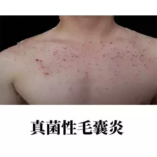 如何拥有美背,拥有美背的人适合学什么舞