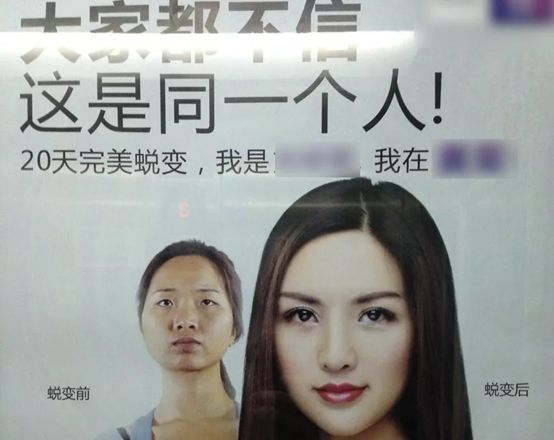 一次脸部微整形换来五年修复路,面部微整形美容前后对比