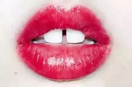 牙缝很大很深能补吗,小的牙缝可以补吗