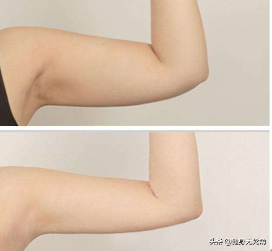 女生手臂越练越粗是什么原因,女生手臂粗减手臂办法