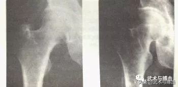 胯松开了，原来是这个样子