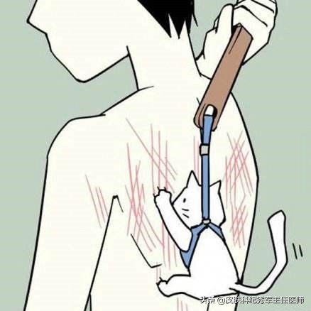 糖尿病瘙痒症的治疗,妇科瘙痒症怎么治疗