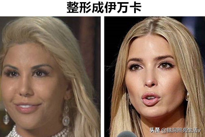 明星模仿秀最像的人图片,疯狂整容把自己整成丑八怪