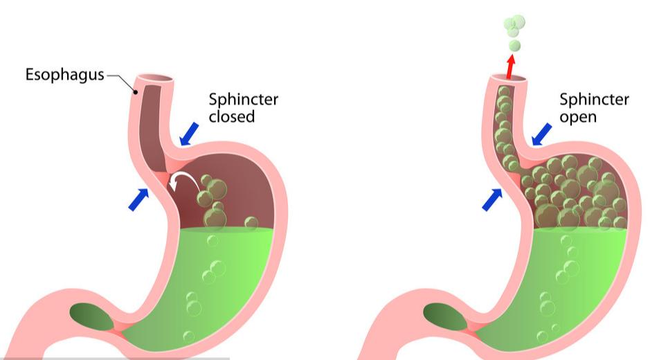 胆囊炎和胃病的鉴别方法,胆囊炎征象什么意思